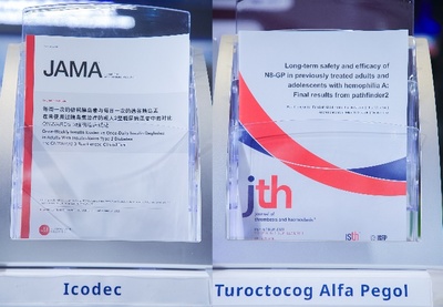 进博会"六年级学长"再赴约,这次带来了四项中国首展产品_中安在线